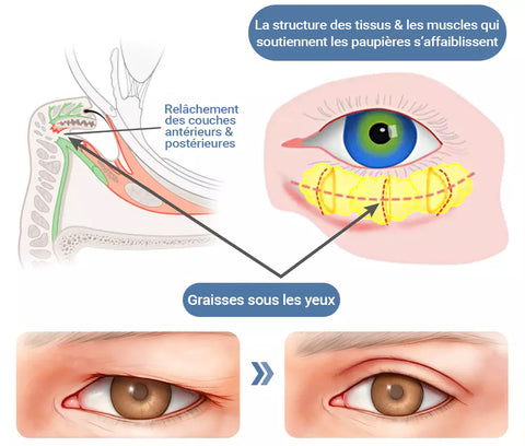 🌙 EAST MOON – La crème contour des yeux qui redonne vie à votre regard