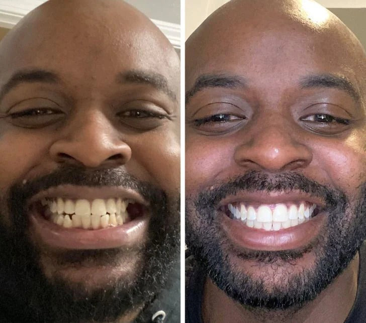 Denzen™ – Le Secret D'un Sourire Lumineux Et Confiant