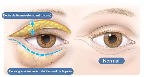 🌙 EAST MOON – La crème contour des yeux qui redonne vie à votre regard