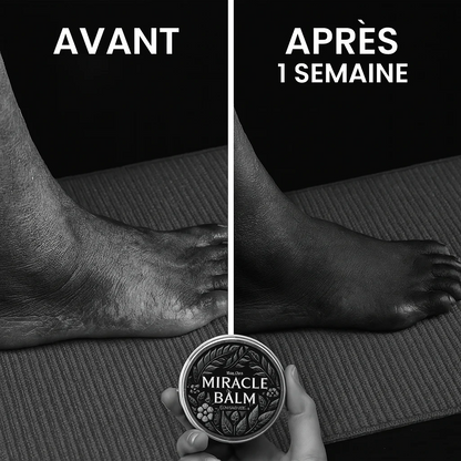 🟢 MIRACLE BALM – Le Baume Naturel Qui Soulage, Apaise et Rafraîchit Immédiatement
