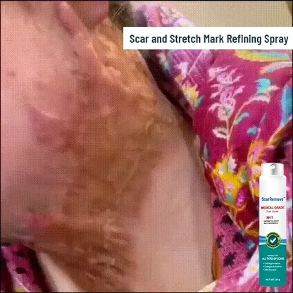 ✨ Medical Grade Scar Spray — Prenez soin de votre peau au quotidien